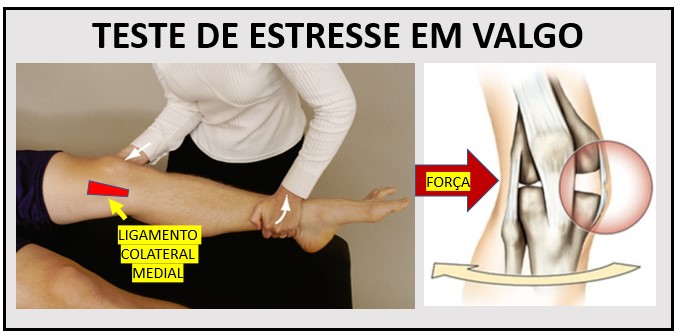 Ligamento Colateral Medial Do Joelho Medicina De Excelência