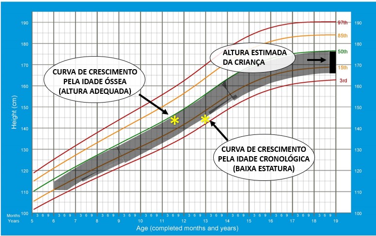 Baixa estatura 3