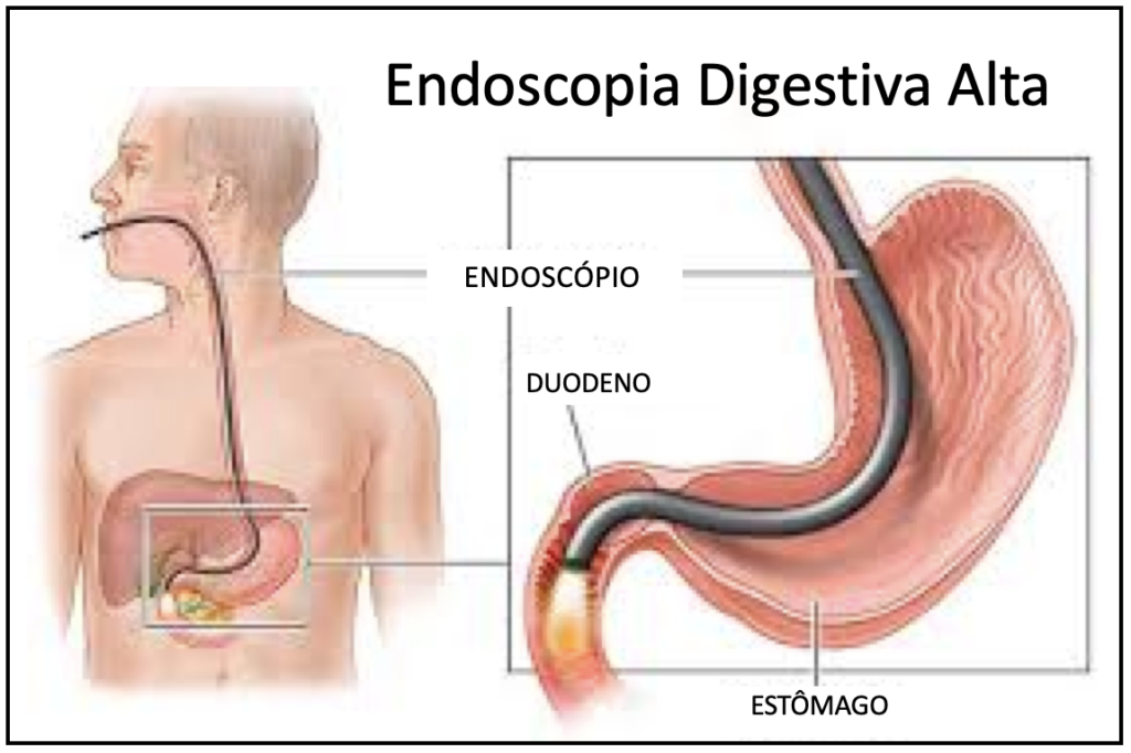 Endoscopia Digestiva Alta - Medicina de Excelência