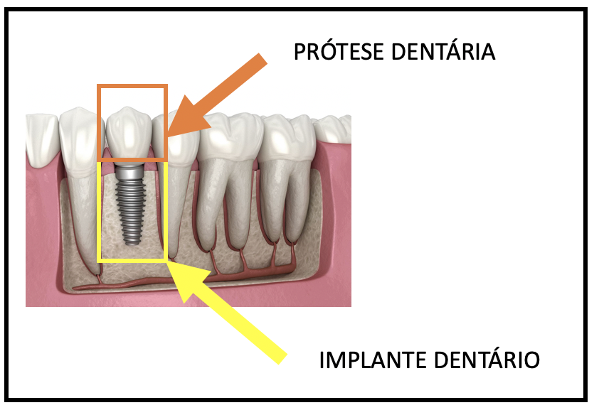 Prótese Dentária - Medicina de Excelência