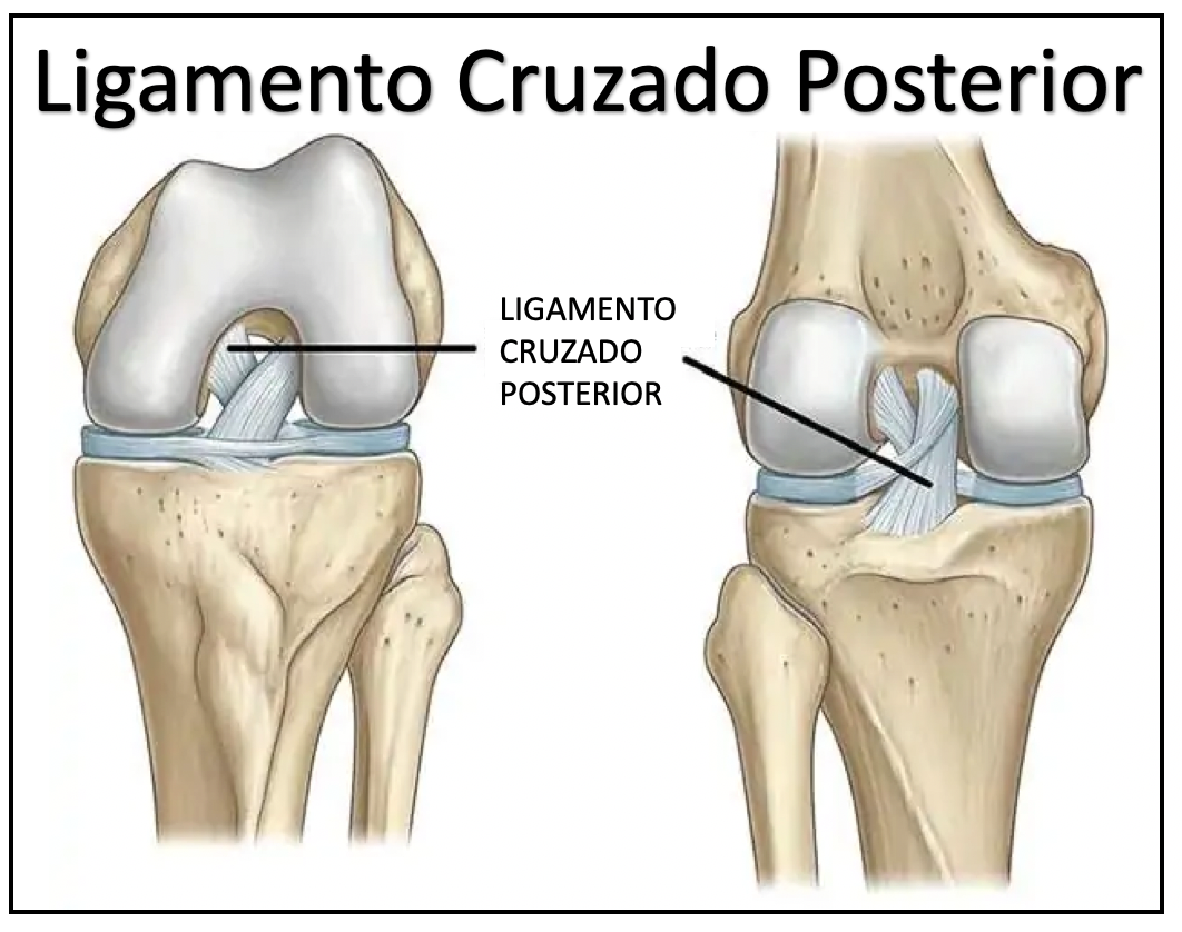 Ligamento Cruzado Posterior - Especialista em Joelho